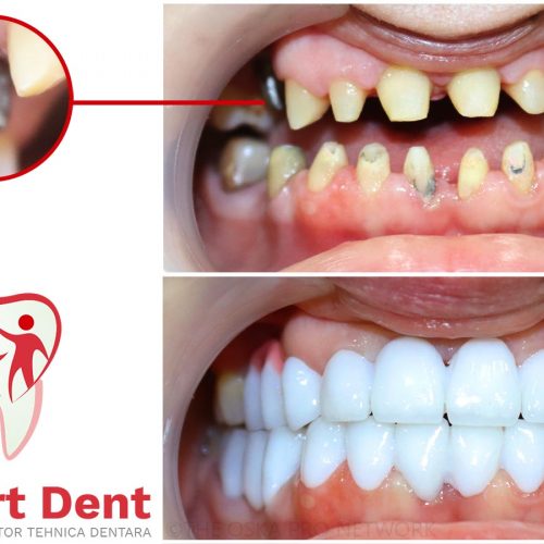 Implantologie Dentara Bucuresti Sector 4